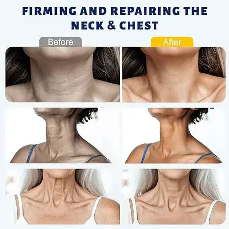 ✨ PPPAW™ Instant Neck Lift Cream — 🧴 Infused with Retinol & Hyaluronic Acid | Firms the Neck, Reduces Wrinkles & Double Chin