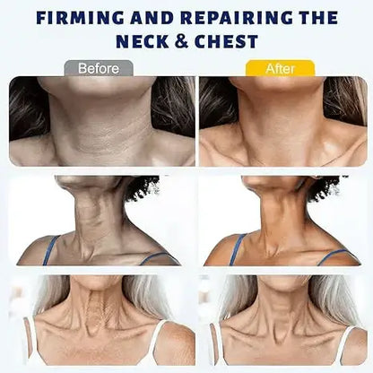 ✨ PPPAW™ Instant Neck Lift Cream — 🧴 Infused with Retinol & Hyaluronic Acid | Firms the Neck, Reduces Wrinkles & Double Chin